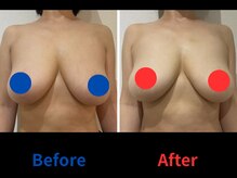 ポインセチア(Poinsettia)/ダイナミックバスト4DX/並び比較