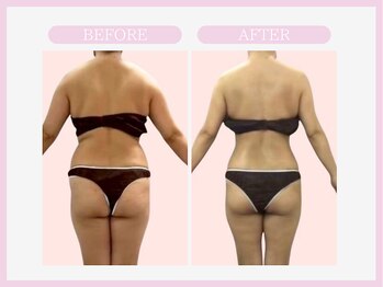 スリムライン 八戸店(The Slim Line)/before→after