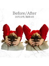 ルーツ 武蔵小杉(R∞ts)/頭の大きさも変わります！