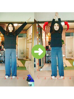 サプライズ整体院/20代ママさんの肩こり初回結果