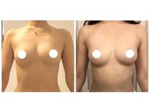 美人バスト 辻堂店の雰囲気(健康にバストアップ!3カップUPの実績多数!卒業後も戻らない!!)