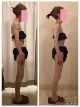 小顔コルギ専門店 フェルーシュ 成田駅前店(Feruche)/背中+小顔コルギ　結果写真