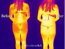 リフィール たまプラーザ店(refiel)/見えるインディバの力