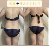 ヨサパーク ハナ 六甲道(YOSA PARK HANA)