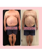 ビューティー アディクト(Beauty addict)/男性の頑固な脂肪の燃焼を促進！