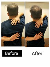 アース エンジェル整体院/ビフォアフ　肩甲骨はがし