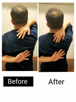 アース エンジェル整体院/ビフォアフ 肩甲骨はがし