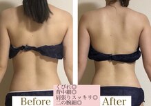ヨサパーク シュエット(YOSA PARK CHOUETTE)
