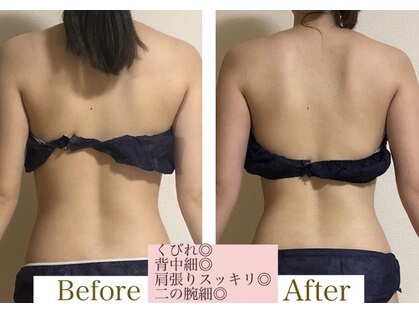 ヨサパーク シュエット(YOSA PARK CHOUETTE)の写真