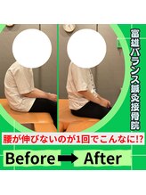 富雄バランス鍼灸接骨院/【猫背の方の施術後】