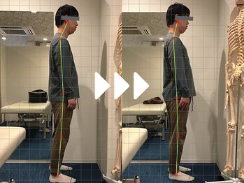 ミライズ整体院 三宮駅前院/事例【20代男性・スマホ首】