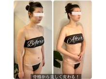 ソウ バイ ソウ(So by 蒼)/全身[調律]小顔矯正でお顔を短く