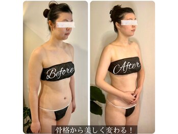 ソウ バイ ソウ(So by 蒼)/全身[調律]小顔矯正でお顔を短く