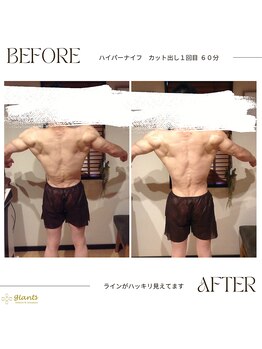 グランツ 小山店/カットだしのお客様　施術１回目