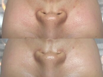 リスト(Rist TOTAL BEAUTY)/LDM