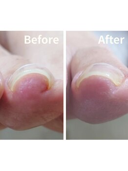 リゼラアンドコー 相模大野店/ドイツ式フットケア専門店