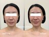 【2回目も同額】都度払い◇眠れる小顔コルギ＋肩甲骨ほぐし 75分