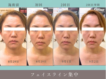 プレジール(plaisir)の写真