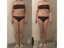 ピカケ(PIKAKE)/筋膜リリース