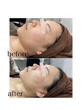 プレシャスサロン(precious salon)/1回の変化～美白＆小顔～