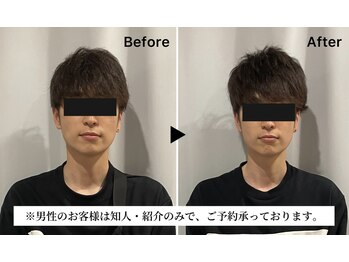 レミュー(Les mieux)/左右対象のお顔に