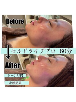 カシェットトーキョー(Cachette Tokyo)/贅沢フェイシャルコース♪