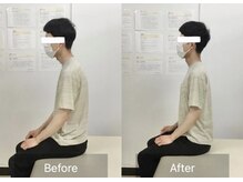 ナオル整体 国分寺院(NAORU整体)/30代男性【姿勢・首の痛み】