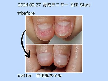 アスネイル(As nail)/深爪育成スタート☆