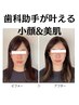 【オプション】リフトアップ美肌エステ（30分）　　＋5,500円