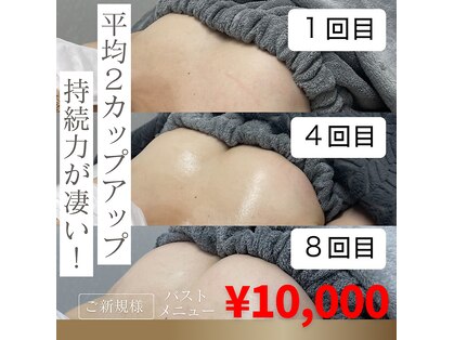オベリオ(OBERIO)の写真