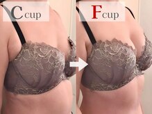 ニンフェア(ninfea)