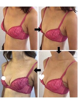 スマイルクルー(SmileClue)/断乳後のバスト変化