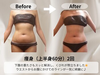 モア 星ヶ丘店(MORE)/痩身 (食事指導あり)