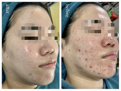 リノルーア(Linolua)の写真