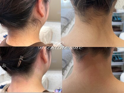 ボーテラボ 大宮(beaute LABO)の写真