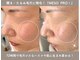 ビオエル(Bioell)の写真