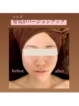 サロンドサマ(salon do SAMA)/人気の小顔骨気（コルギ）１