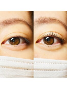 リファイン(Refine)/