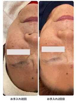 エアリアル 南行橋店/マスク老化に負けない肌に