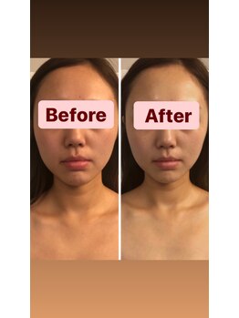 小顔コルギサロン シー(She)/【コルギ】1度の変化!