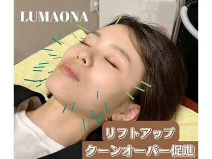 ルマオーナ(LUMAONA)の写真