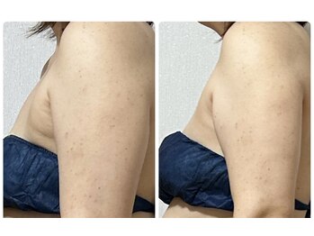 ヨサ パーク コアハート(YOSA PARK CORE HEART)/紙ブラでこんなにわかる!