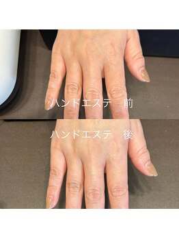 リンク(LINK)/ハンドエステ