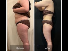 グラシアス サロン(GRACIAS SALON)/人気NO1ガッツリ痩身エステ