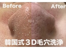 ベル(BELL)/毛穴ごっそり/頑固な黒ずみ撃退