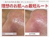 【黒ずみ＆凹凸徹底改善】角栓全顔取り放題×肌質改善ハーブ　¥24300→¥14300