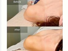 アンワインド(UNWIND)/デコルテトリートメント