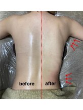 エミット(emit.)/温活腸リンパマッサージ