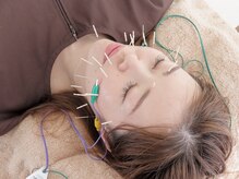 こころ晴れ鍼灸院の雰囲気（お顔のたるみもすっきりリフトアップ！美容鍼/小顔矯正）