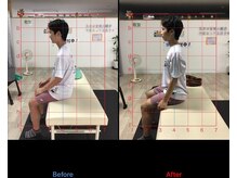 ストレチックス 近江八幡店/ストレッチ　ビフォーアフター